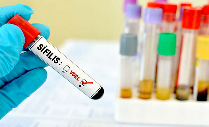 Pernambuco registra aumento de 183% em casos de sífilis