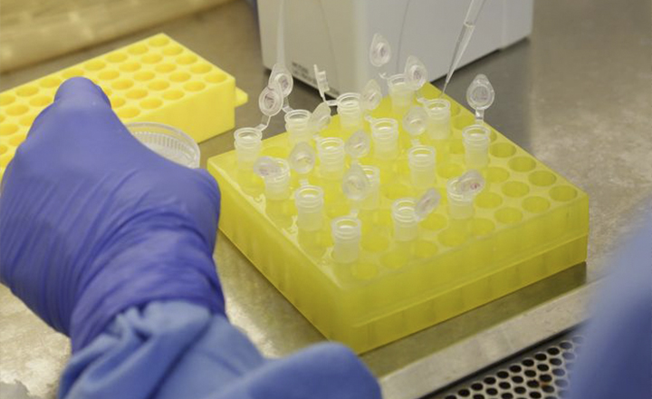 Caruaru tem o 1° caso confirmado do novo coronavírus