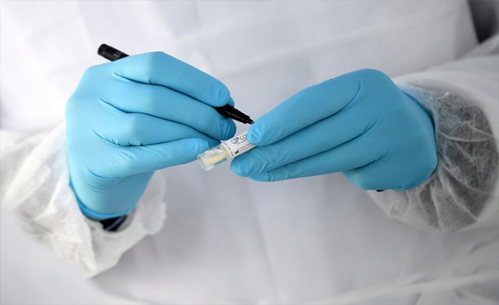 Anvisa aprova três novos testes de Covid-19