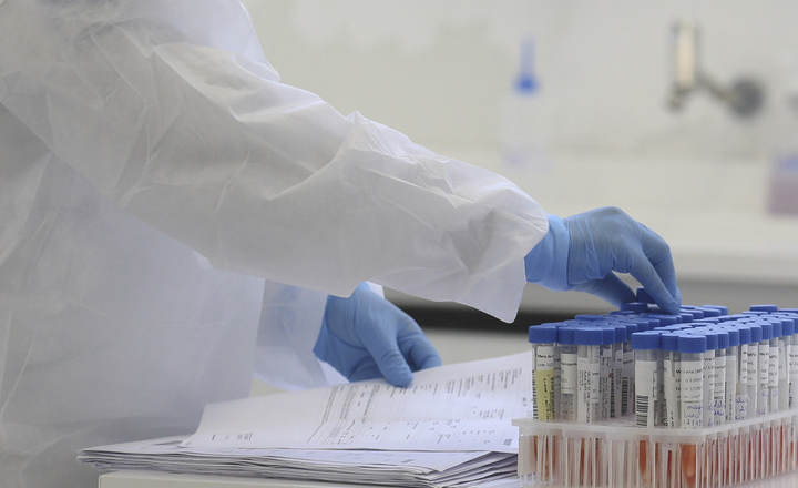 Governo de Pernambuco abre vagas para técnicos de laboratório em Caruaru