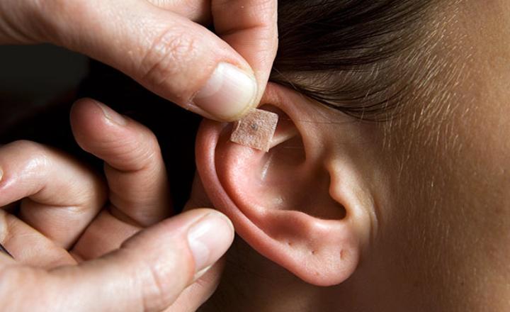 Secretaria de Saúde capacita profissionais pernambucanos em auriculoterapia