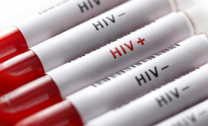 Pernambuco cria comitê de investigação de óbitos por Aids