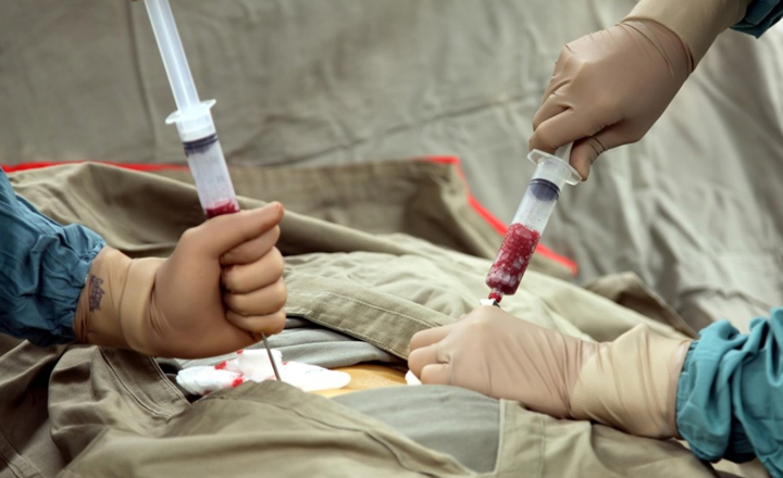 Cadastros de doadores de medula óssea em Pernambuco têm aumento de 173%