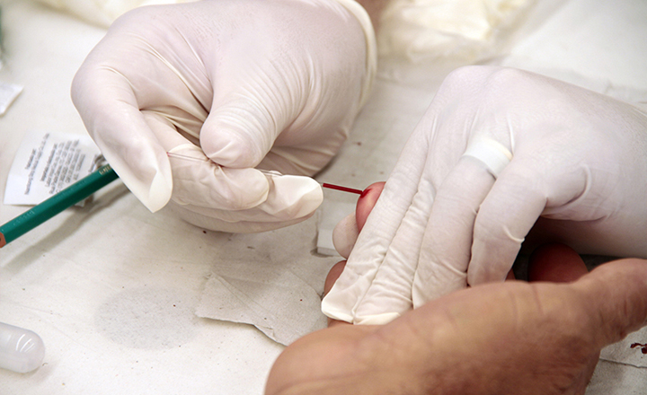 Pernambuco registra mais de 1.600 casos de HIV em 2018