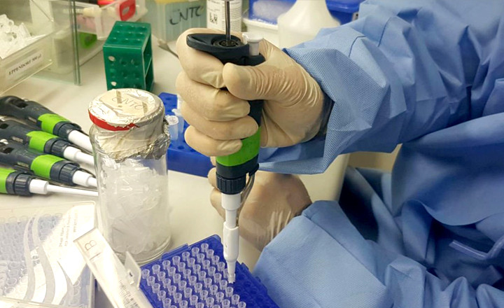 Fiocruz Pernambuco desenvolve teste rápido para Zika