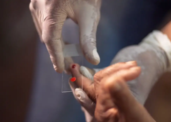 SUS começa a usar novo tratamento contra a malária em crianças